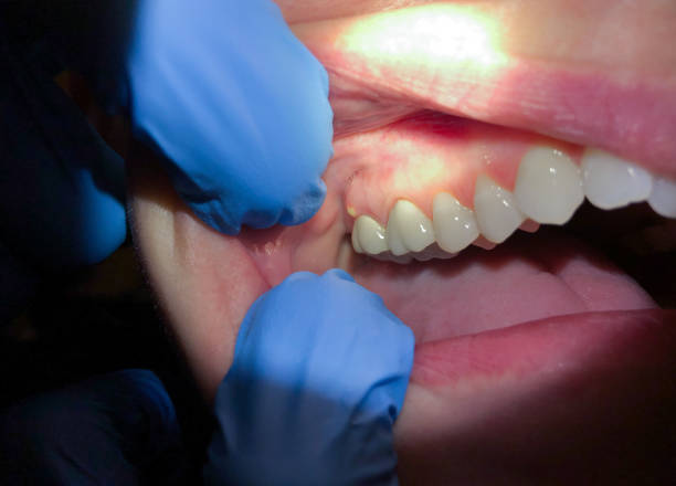 Best Emergency Orthodontic Repairs in Cassopolis, MI